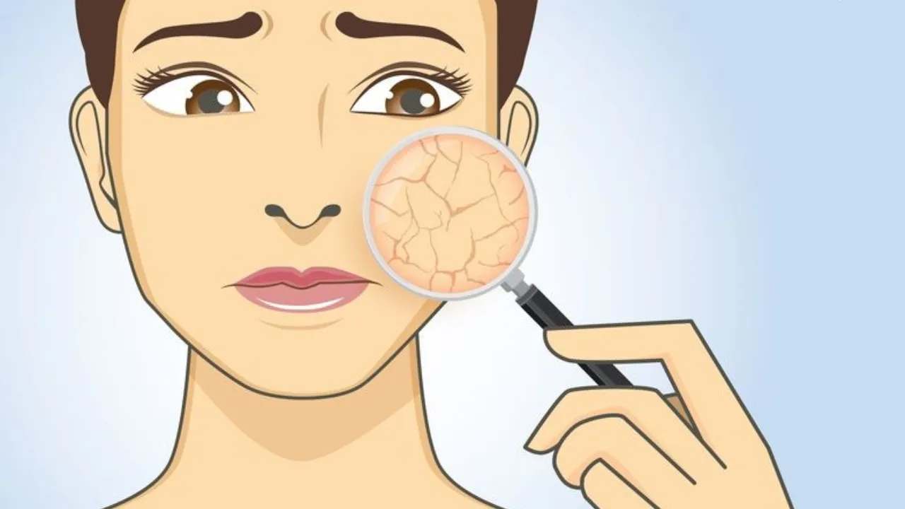 Cure Of Rough Skin