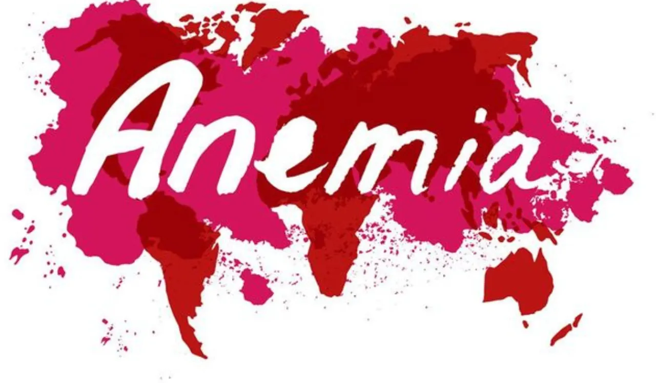 anemia (Pinterest)