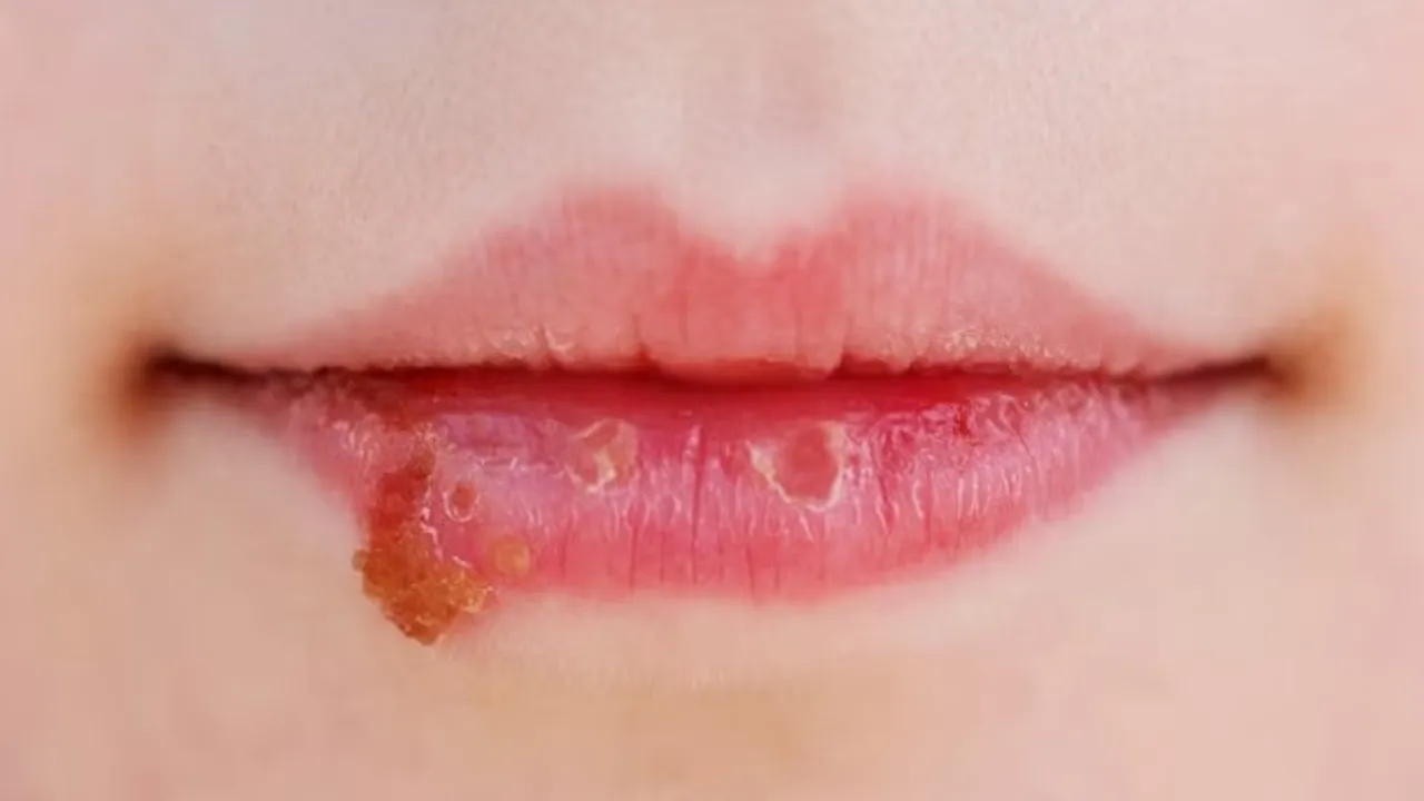 v