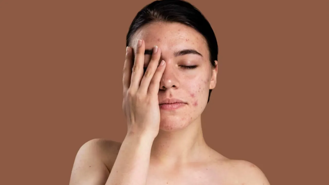 Dead Skin Cells(Freepik)