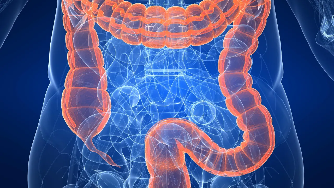 Colon cancer symptoms