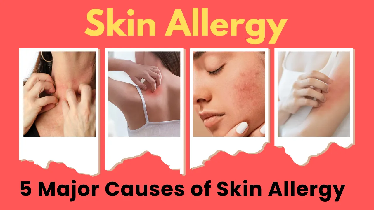 skin allergy 