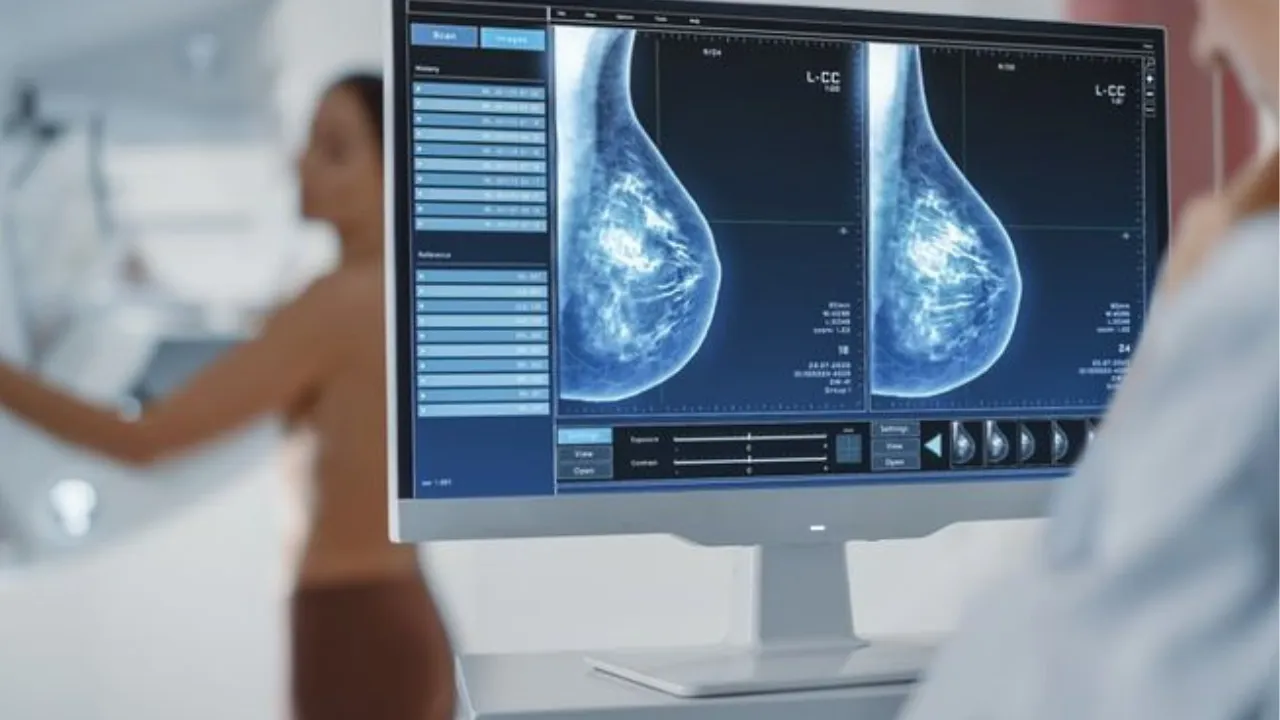 What is Mammography