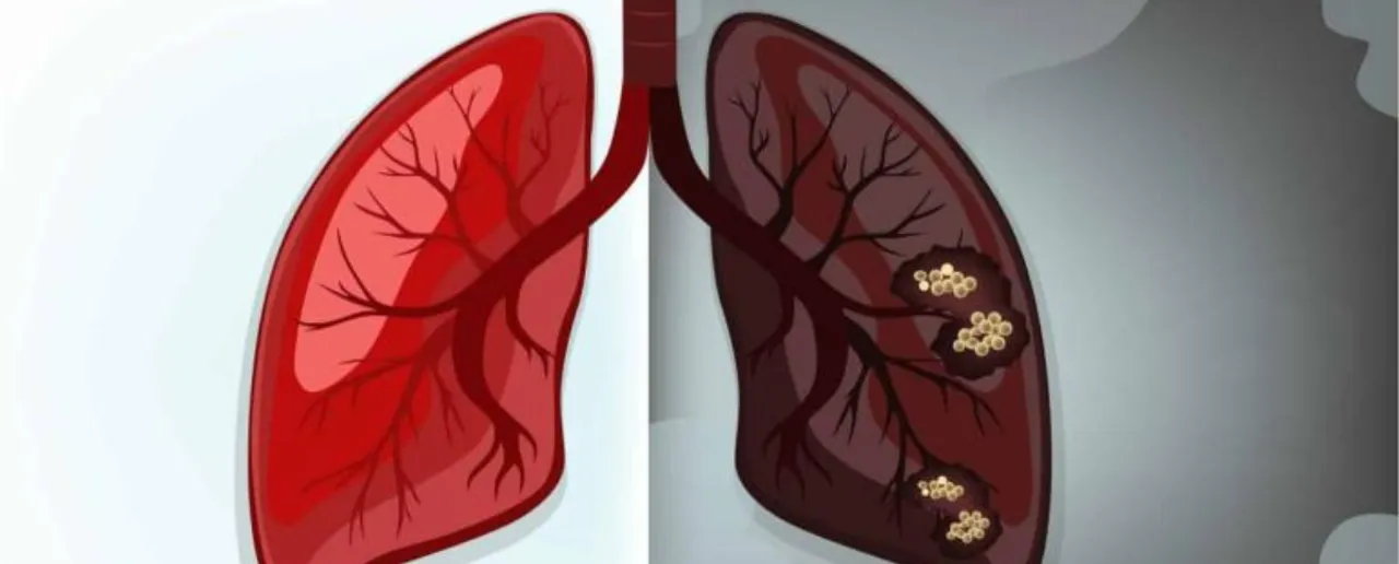 Lungs Health