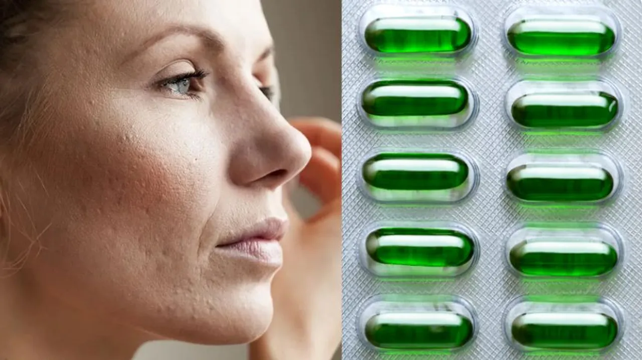 Vitamin E for skin 