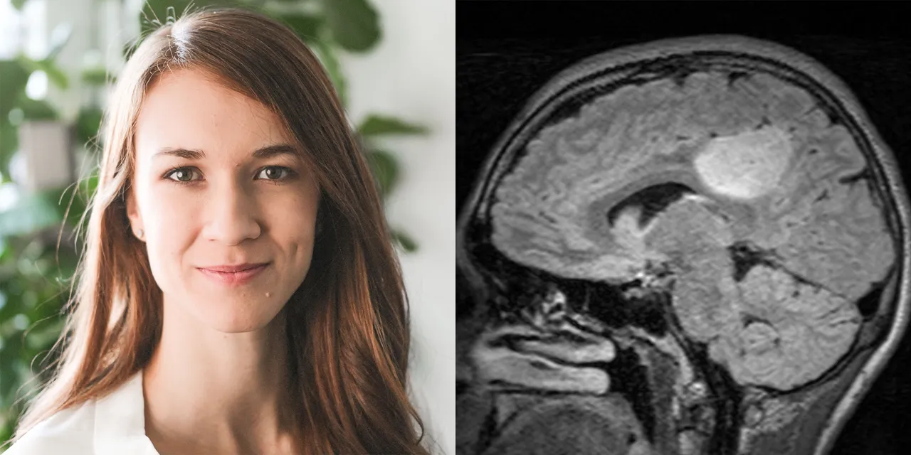 brain-tumor