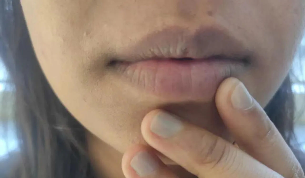 lips(Derma Essentia).png 