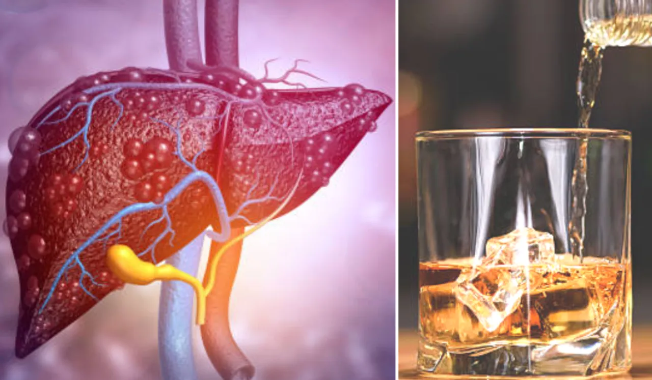 Worse For Liver(Navbharat times)