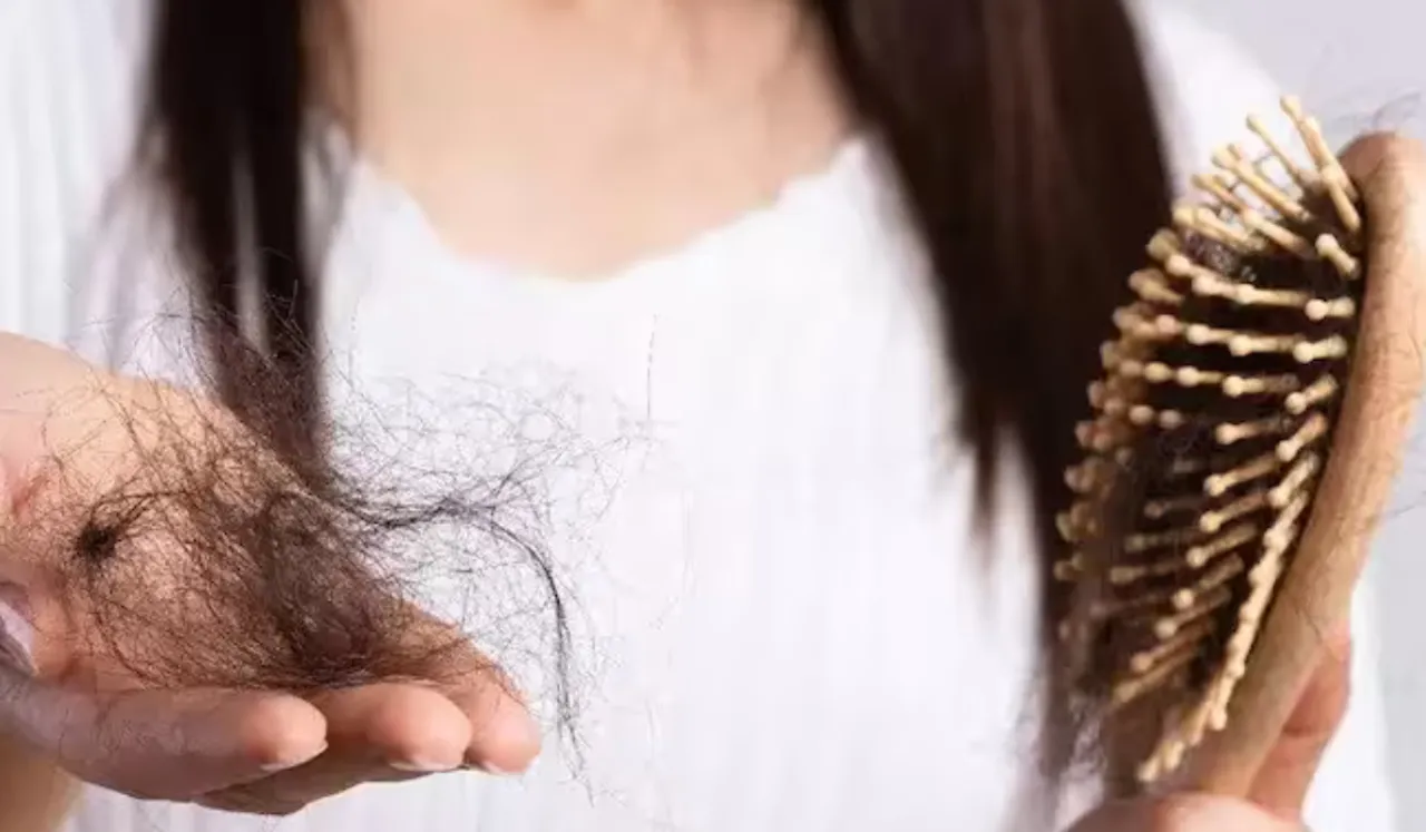 HairFall (IC-ABPNews)