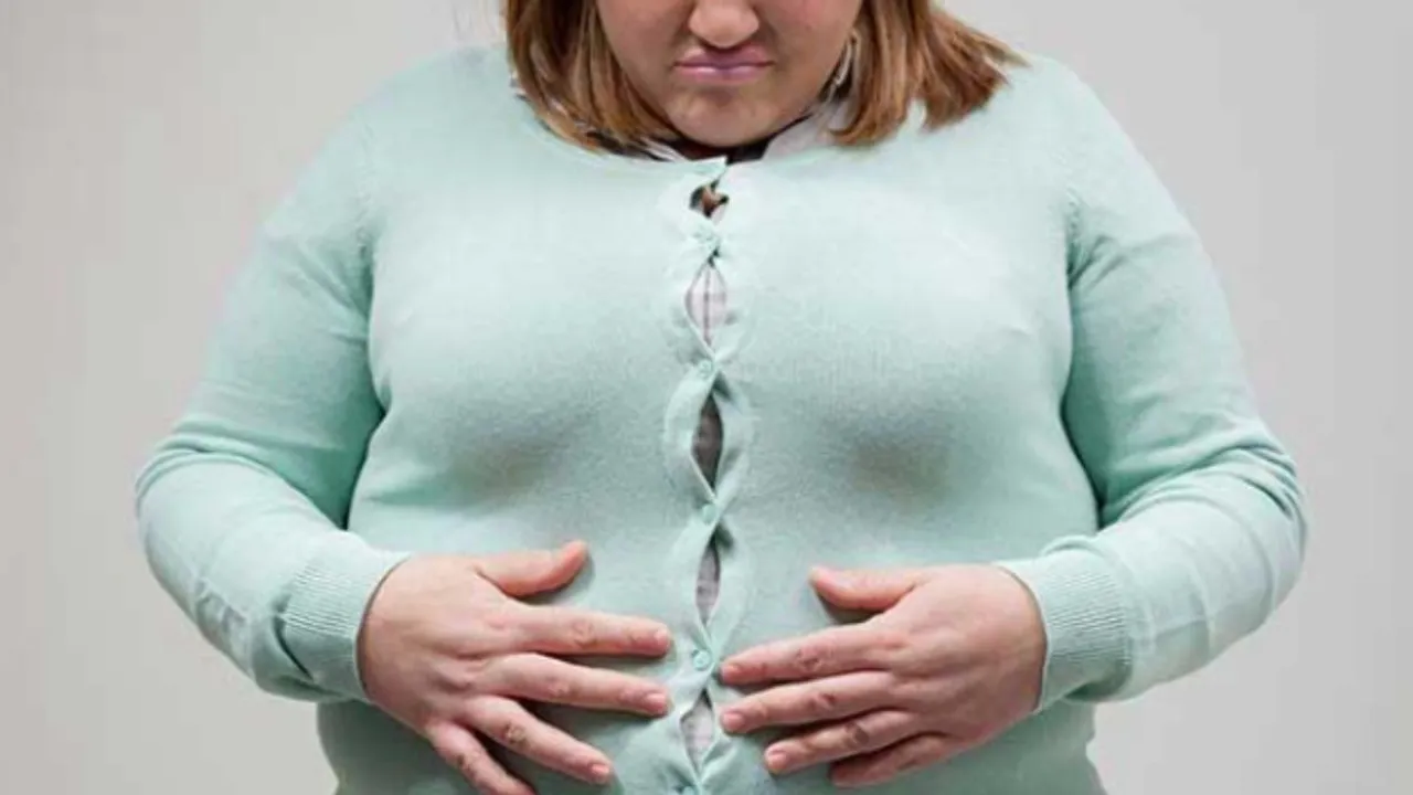 OBESITY).jpg