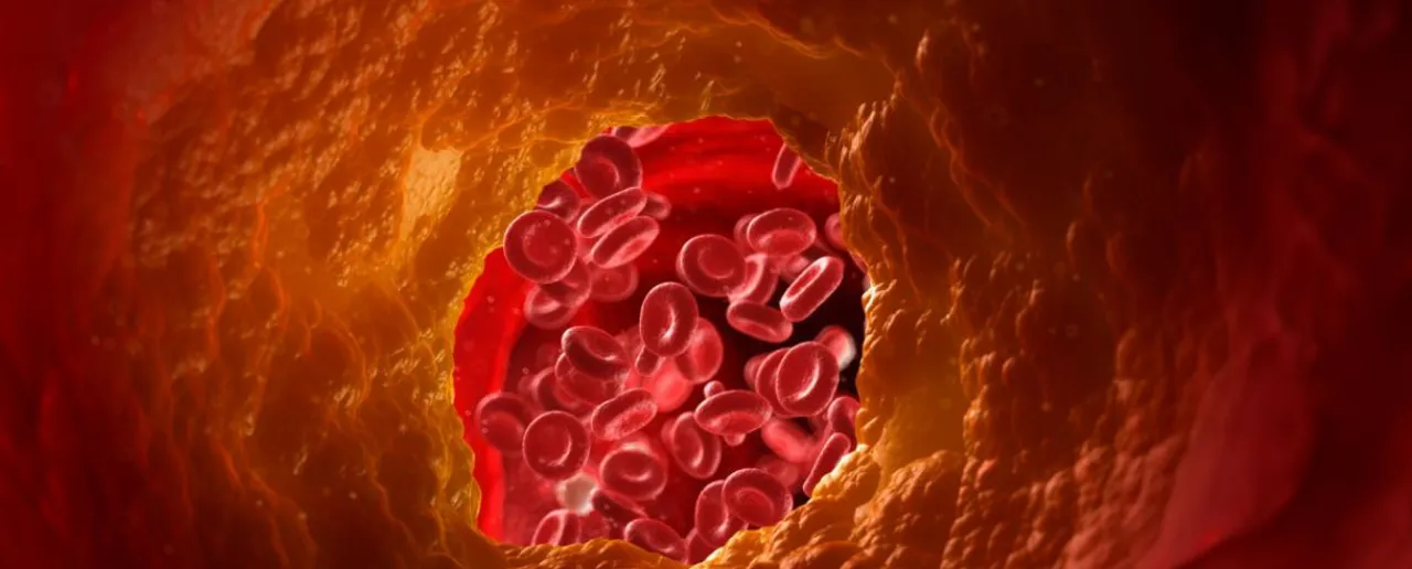 Cholesterol