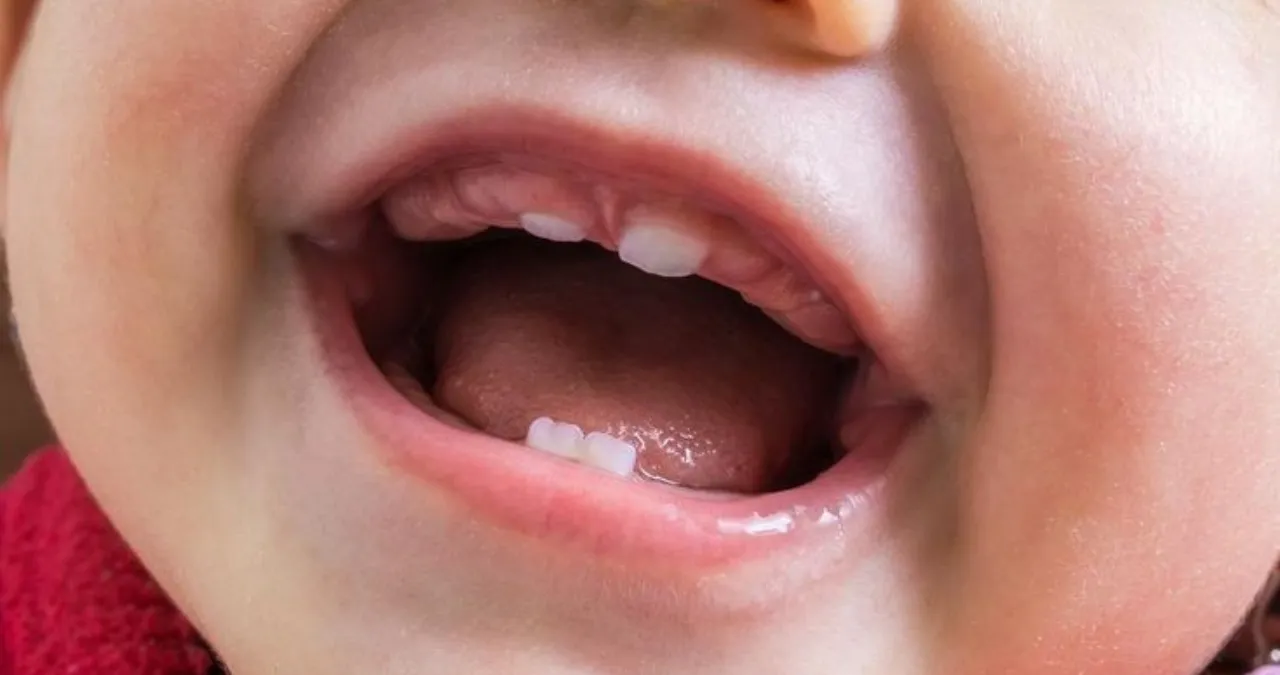 Newborn first tooth