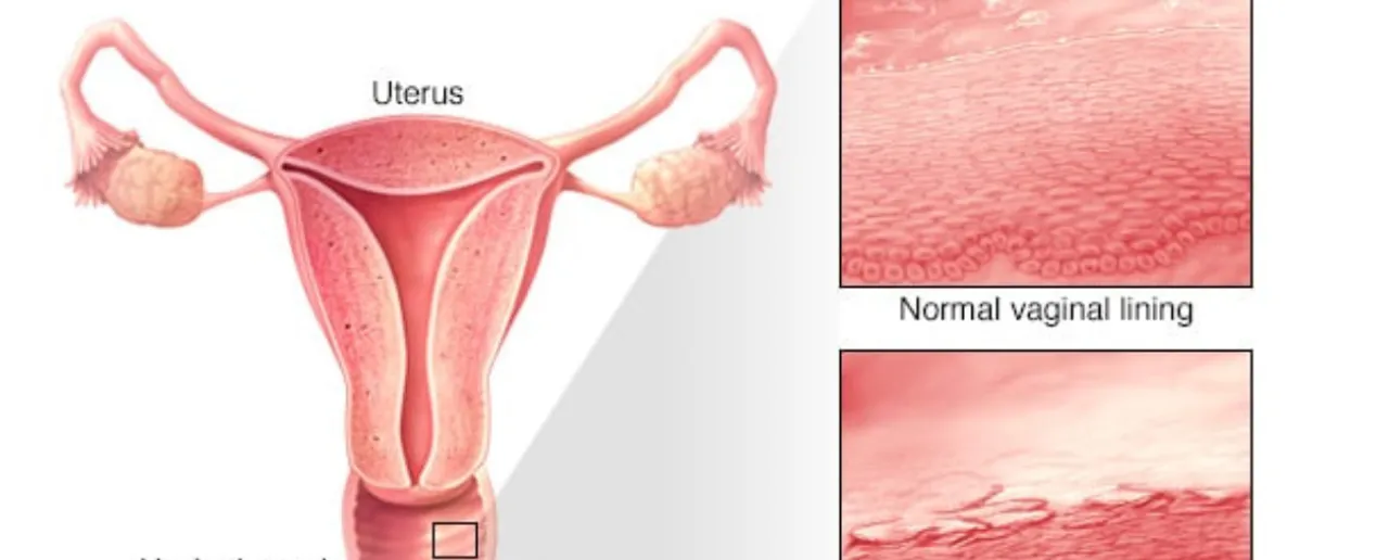 Vagina img.png