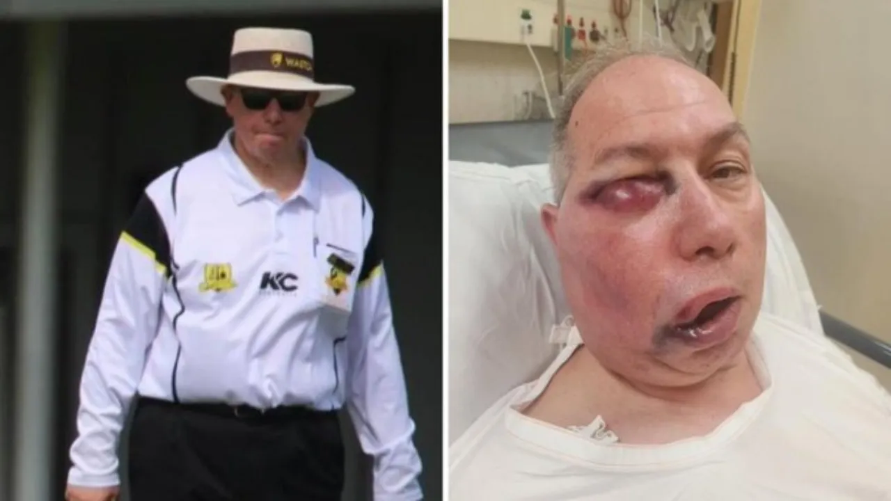 Aussie umpire hospitalized