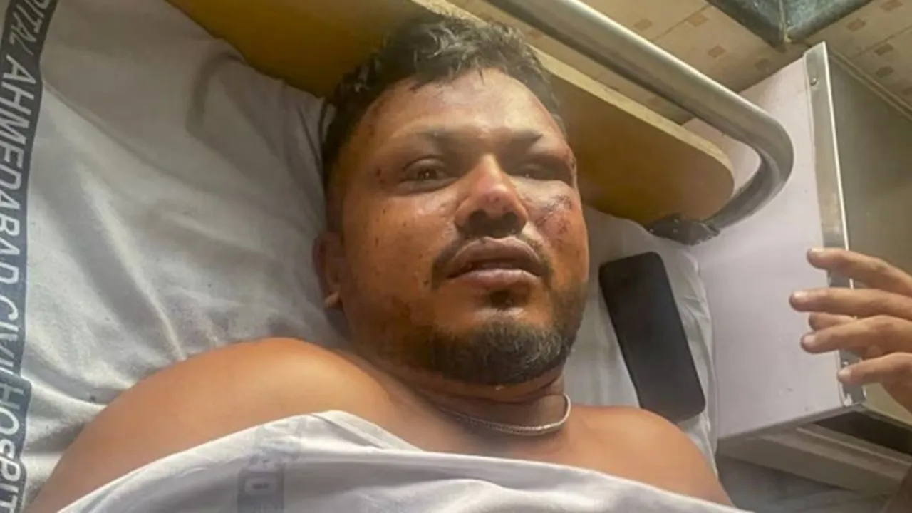 plane crash, plane crash Ahmedabad, Air India plane crash survivor, Air India Vishwas Kumar Ramesh, British-Indian survivor, Ahmedabad plane crash, Air India seat 11A survivor, Gujarat air disaster, Air India lone survivor account, Air India miracle survival story, air travel safety concerns, survivor trauma account, Ahmedabad plane crash, Gujarat plane crash, Gujarat plane crash live news, ahmedabad plane crash news, Gujarat news, meghaninagar plane crash, meghaninagar plane crash news, meghaninagar plane crash latest news, indian express,আহমেদাবাদে বিমান দুর্ঘটনা,বিমান দুর্ঘটনা,বিশ্বাসকুমার রমেশ,রমেশ বিশ্বাসকুমার,দুর্ঘটনাগ্রস্ত বিমানের একমাত্র জীবিত যাত্রী বিশ্বাসকুমার রমেশ