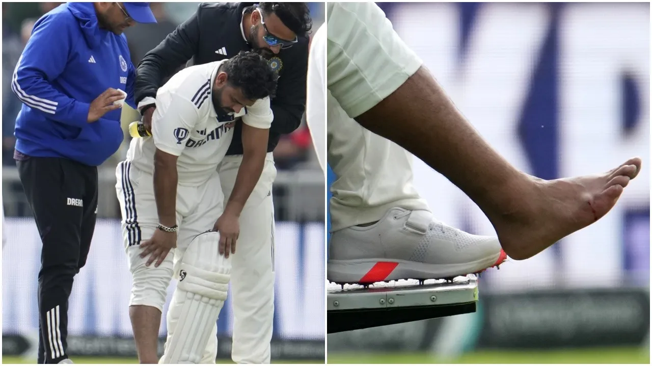 Rishabh Pant Injury Update: যদি পন্থের চোট গুরুতর হয়, তাহলে কি ভারত ‘কনকাশন সাবস্টিটিউট’ নিতে পারবে?