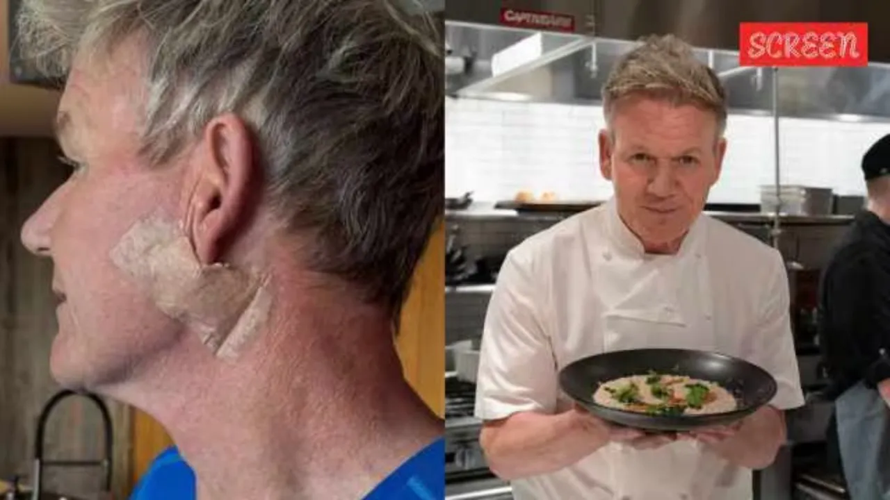 Gordon