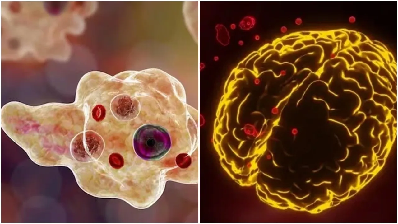 Deadly brain-eating amoeba