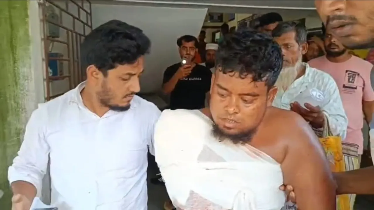 Hariharpara bus accident,  Murshidabad road accident  ,Passenger hand injury  ,Bus and truck collision,  Road safety incident  ,Hospitalized accident victims,  Window safety hazard  ,Traffic accident Murshidabad,হরিহরপাড়া দুর্ঘটনা,  মুর্শিদাবাদ সড়ক দুর্ঘটনা  ,বাস ও পণ্যবাহী গাড়ির সংঘর্ষ,  যাত্রীর হাত কেটে পড়ল,  সড়ক নিরাপত্তা,  আহত যাত্রী  ,চলন্ত বাসে বিপদ,  হরিহরপাড়া হাসপাতালে স্থানান্তর