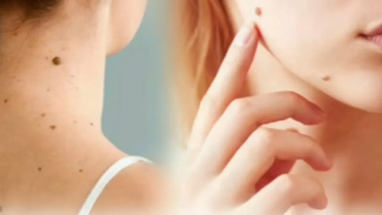 Mole Astrology: তিল দেখে নারীর স্বভাব জানুন!