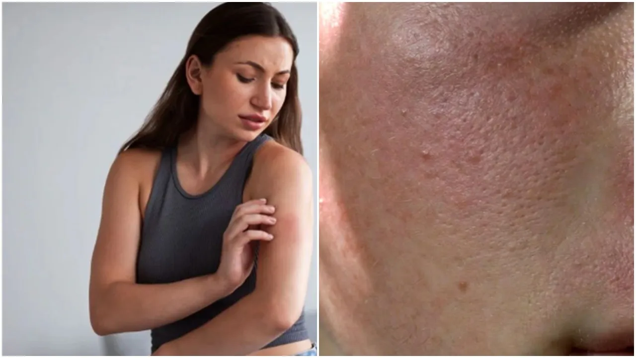 Winter Itching Tips: শীতকালে বাড়ে চুলকানি, জেনে নিন রোখার সহজ টিপস।