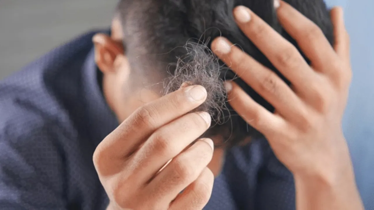 Hair Loss: চুল পড়ার সঠিক সমাধান কী, জেনে নিন।