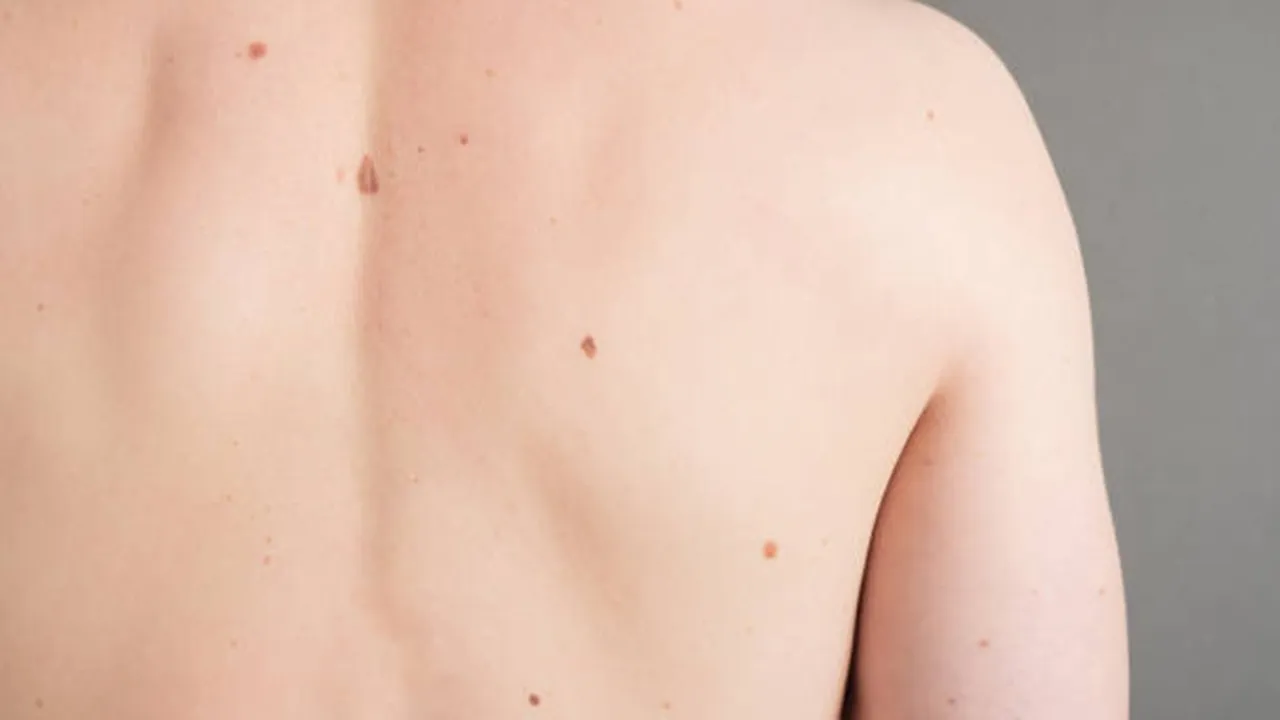 Birthmark Astrology: শরীরের জন্মচিহ্নের রহস্য জেনে নিন।