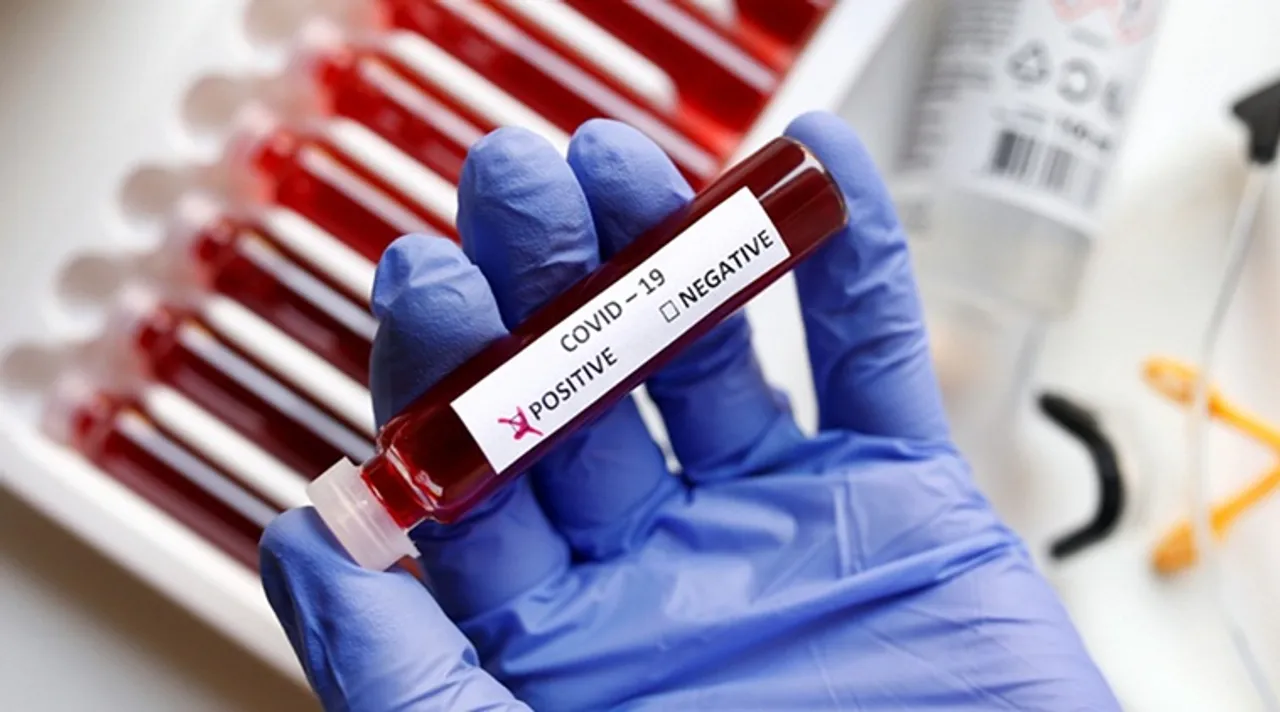 coronavirus, করোনাভাইরাস, করোনা আপডেট