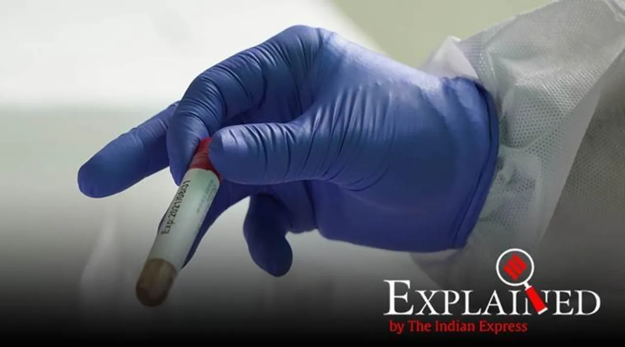 Rapid Antigen Test