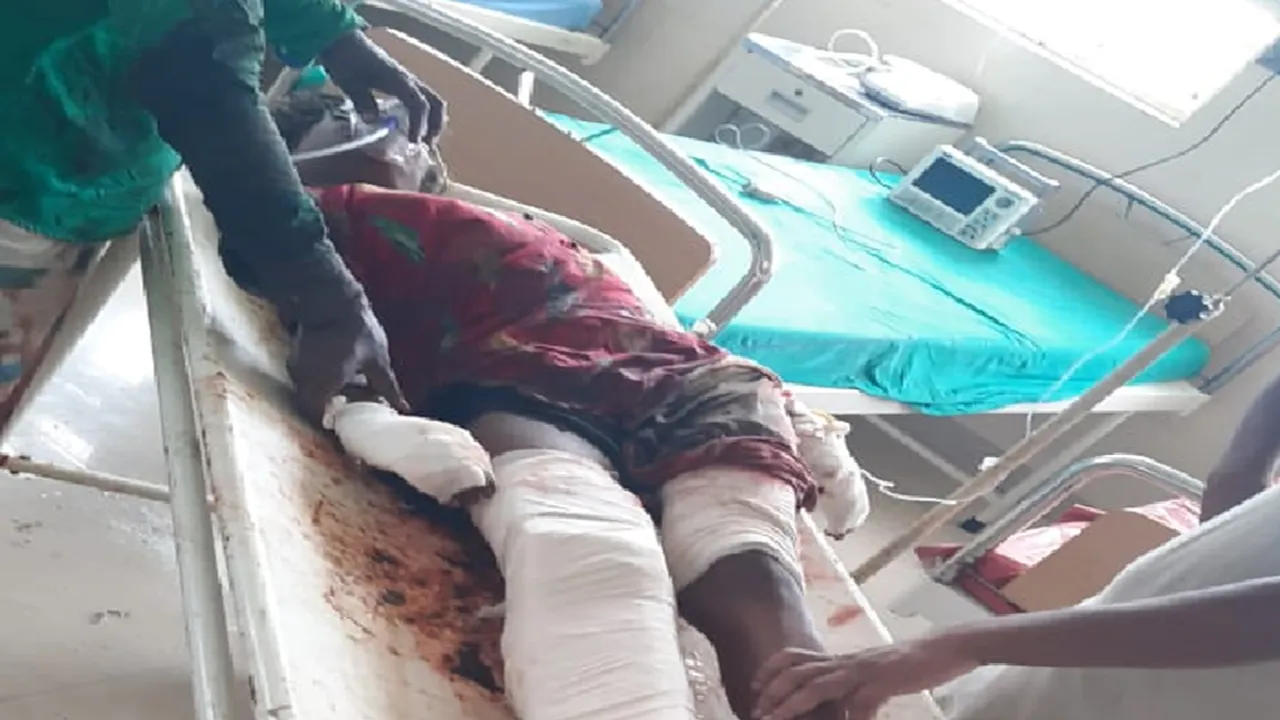 Child died due to explosion at nandigram, seriously injured more two