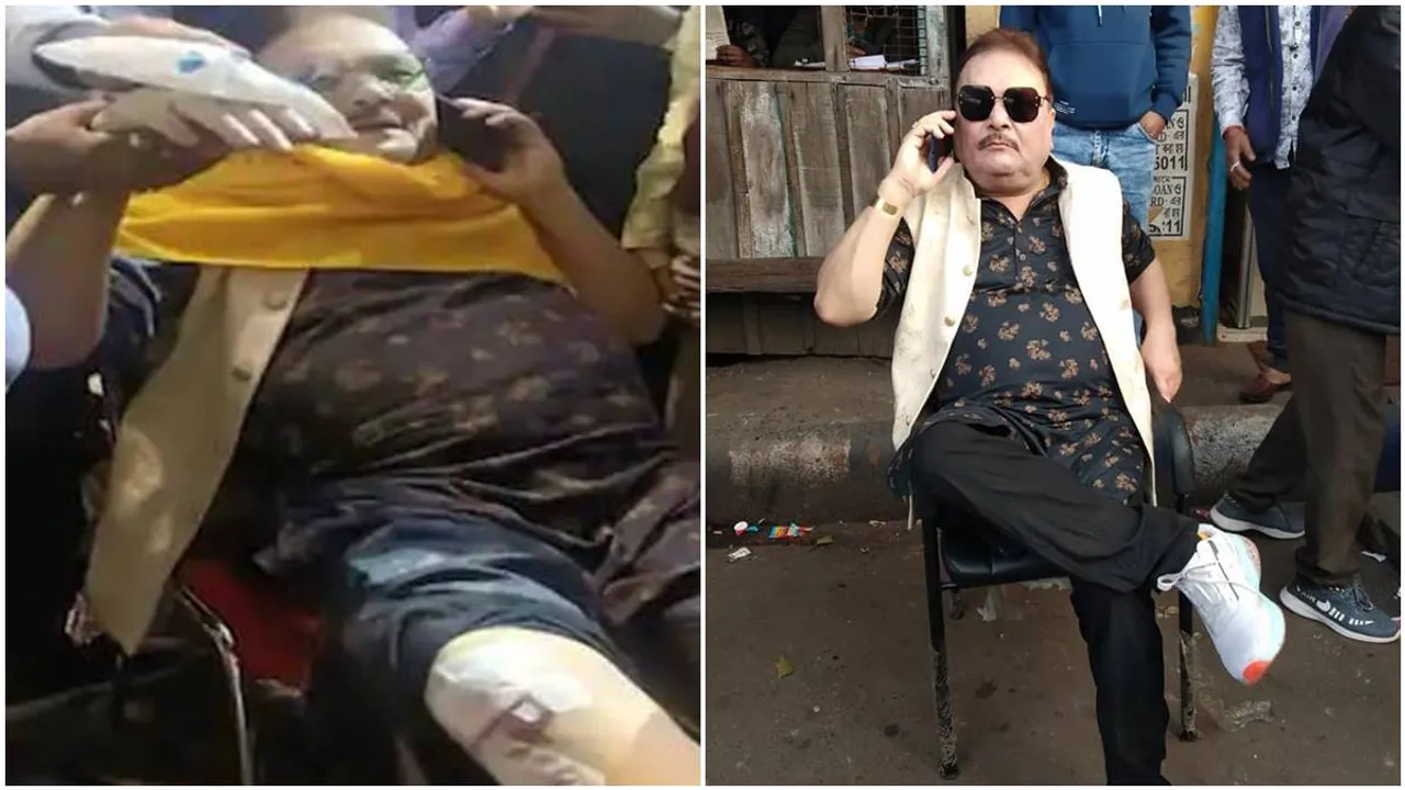 TMC MLA Madan Mitra injured in road accident