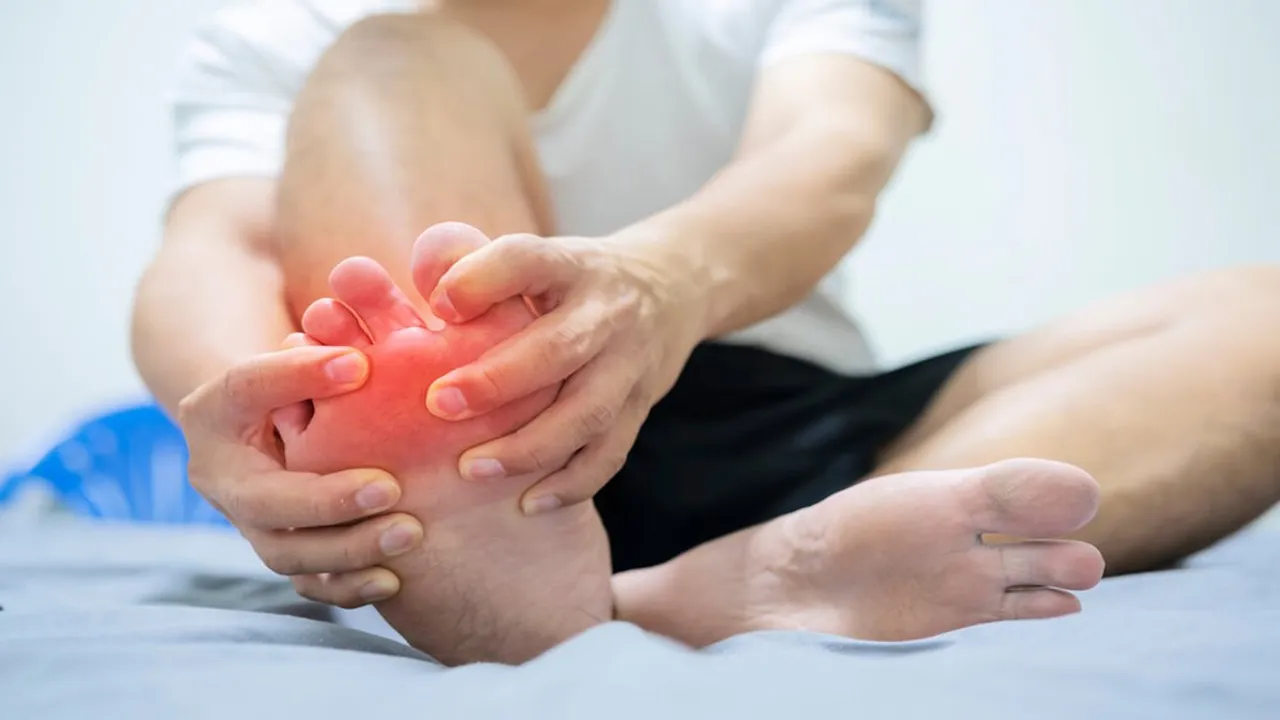 gout arthritis - joint pain