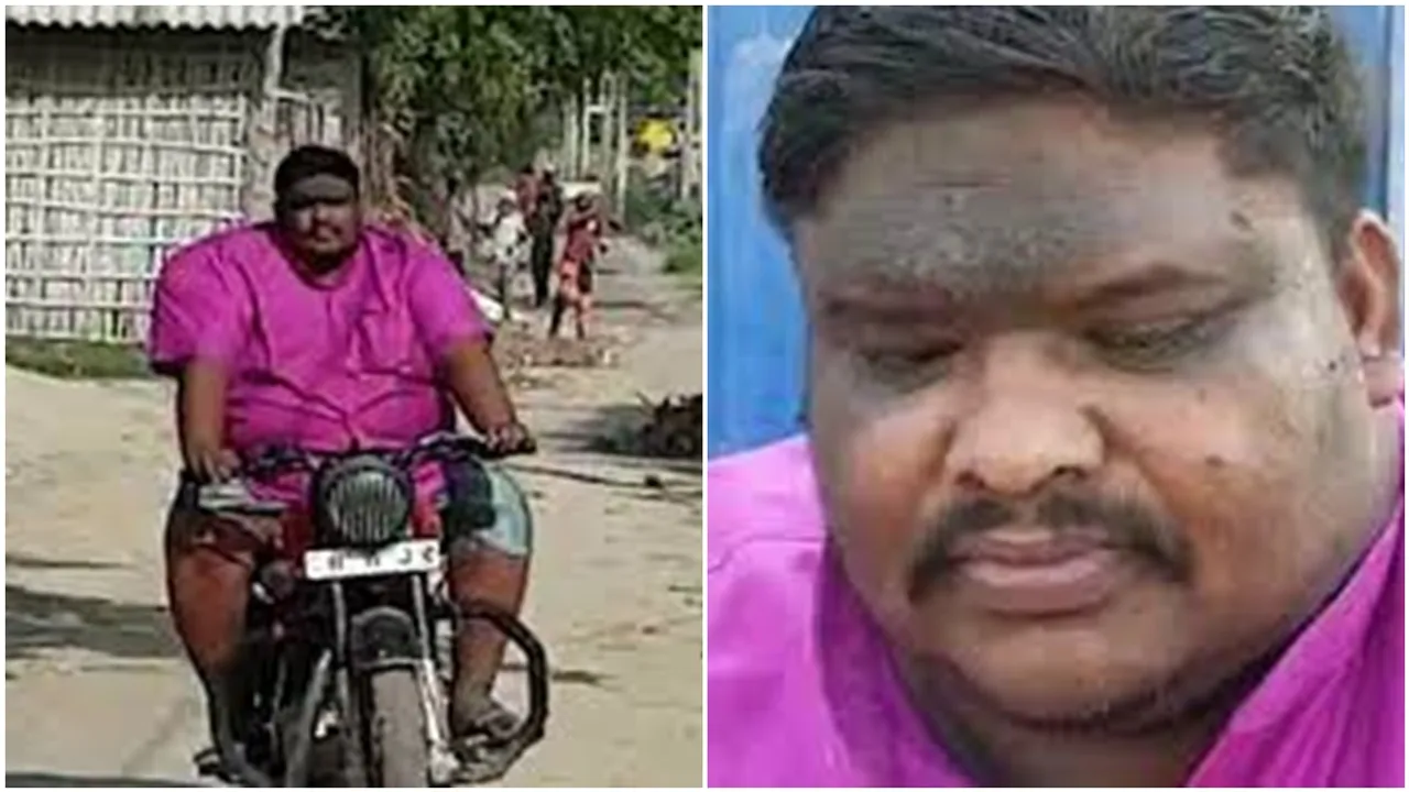 Bihar Katihar man suffering from Bulimia Nervosa, Bihar man suffering from Bulimia Nervosa, Katihar man suffering from Bulimia Nervosa, বেশি খিদের কারণ, বেশি খিদের কারণ কী, বেশি খিদের কারণ কী কী, বেশি খিদের কারণ কী হতে পারে, কেন বেশি খিদে পায়, বেশি খেলে কী হয়, বেশি খিদের কারণ জানুন, eating disorder