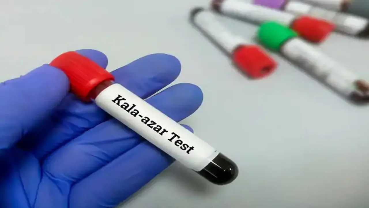 Kala-azar, Kala azar, black fever, kala azar in west bengal, black fever causes, black fever treatment, who, kala azar causes, Bankura,Birbhum,Black Fever,Dakshin Dinajpur,Darjeeling,Kala Azar,Kalimpong,Malda,Murshidabad,Purulia,Uttar Dinajpur,Visceral leishmaniasis,West Bengal