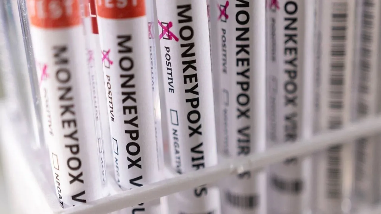 monkeypox