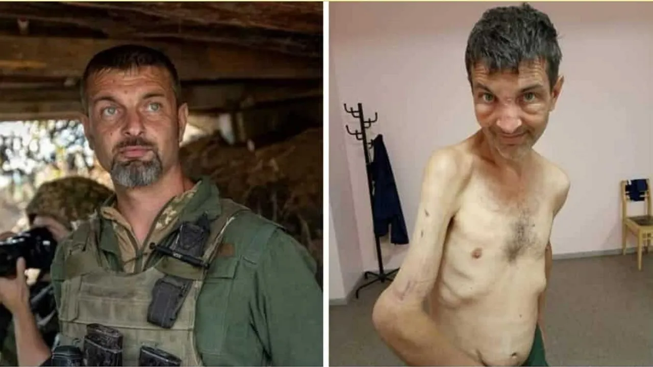 Mykhailo Dianov,Ukrainian Azov regiment,Ukraine Soldiers,Ukraine Soldier Before and After,Russia War,Ukraine Russia War,Russians,news,English news,India news,breaking news,Latest News Breaking and Latest news,online news world news,Russia-Ukraine War,Russia-Ukraine War News,Russia-Ukraine War Latest News,Russia-Ukraine War News Today,Azovstal steel plant,Mariupol port city,India,Russia Ukraine War,viral news