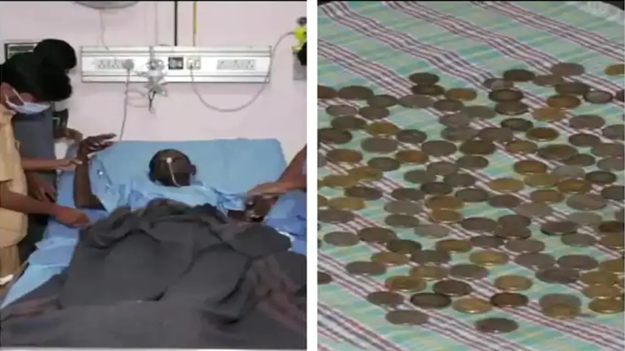 Amazing news,karnataka news hindi,doctors astonished,187 coins in patients abdome