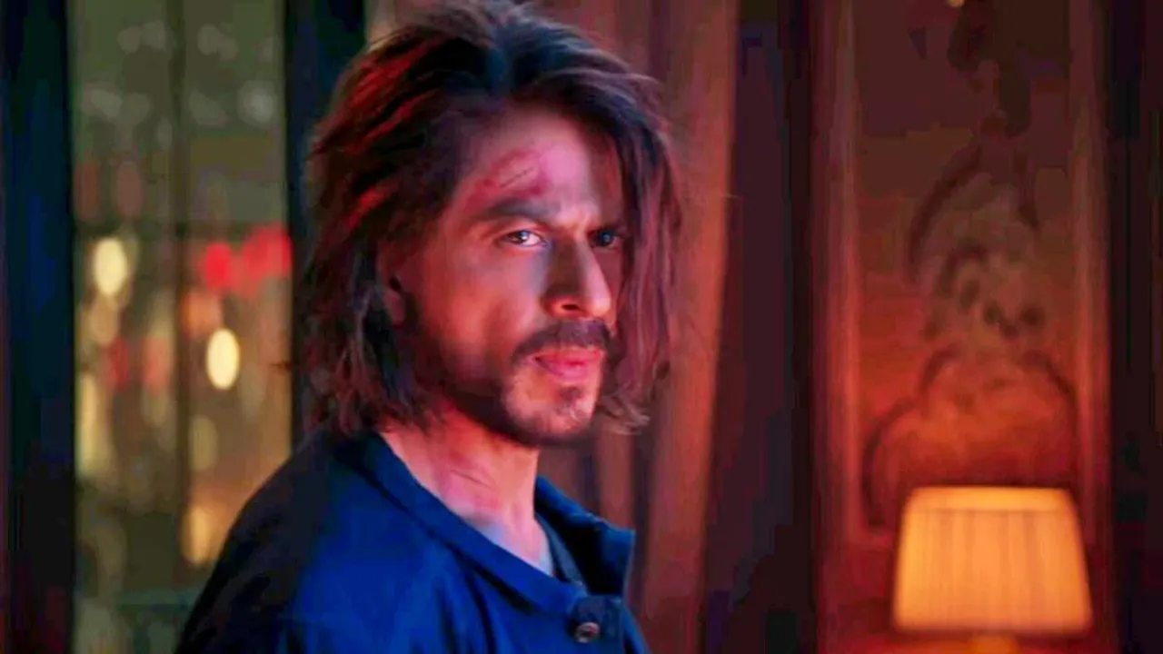 Shah Rukh Khan, Shah Rukh Khan accident, Shah Rukh Khan surgery, Jawan, shah rukh khan, Shah Rukh Khan news, Shah Rukh Khan update, shah rukh khan bollywood, Shah Rukh Khan update, tollywood news, entertainment news, latest entertainment news, বিনোদন, আজকের বিনোদনের খবর, ie entertainment news, entertainment update, Indian express entertainment news