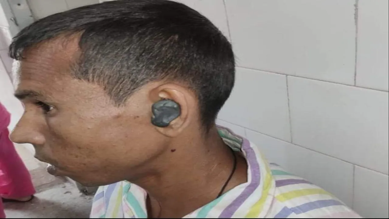 fake doctor apply msil in man ear in katwa