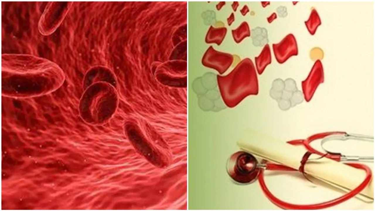 Thalassemia