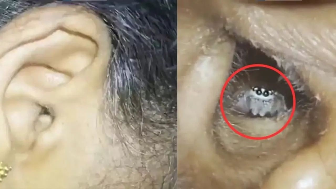 viral video, today viral video, trending video, video, viral news, ear, ear worm, worm, viral video ear, ear viral video