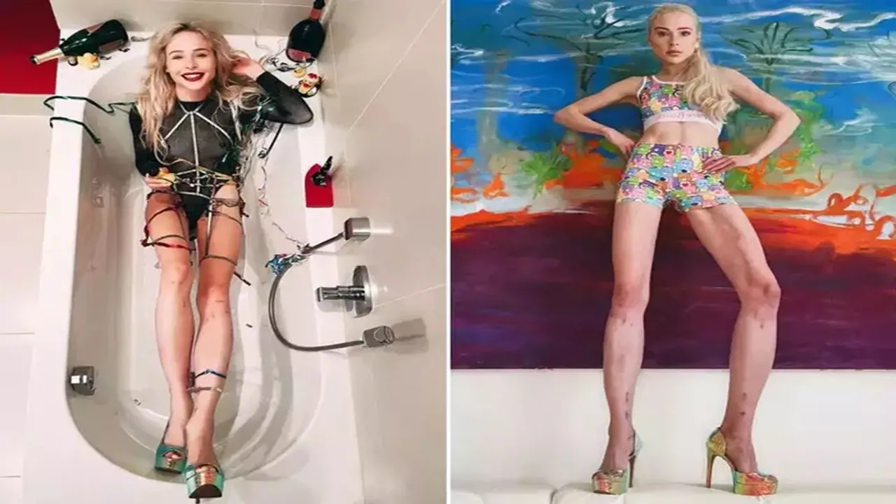 Lengthening Legs Surgery