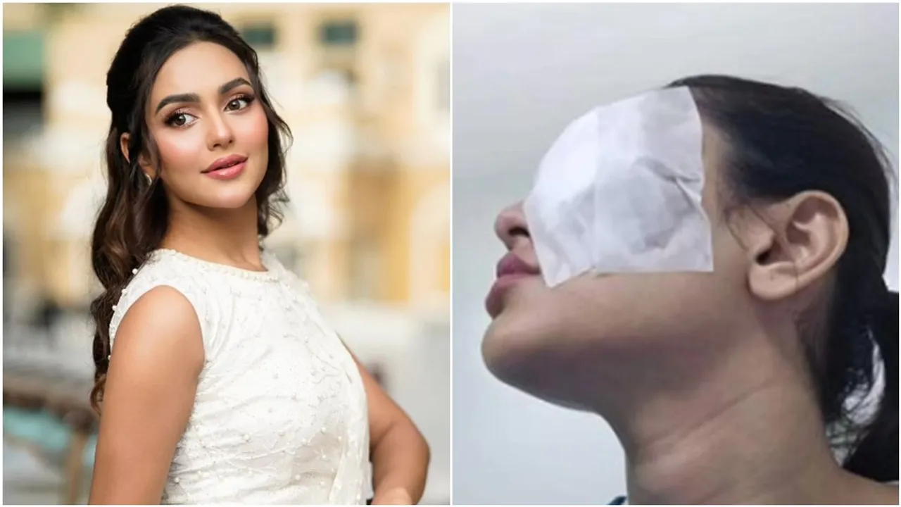 nusrat faria, nusrat faria news, nusrat faria bangladeshi actress, nusrat faria eye operation, নুসরতের চোখ অপারেশন