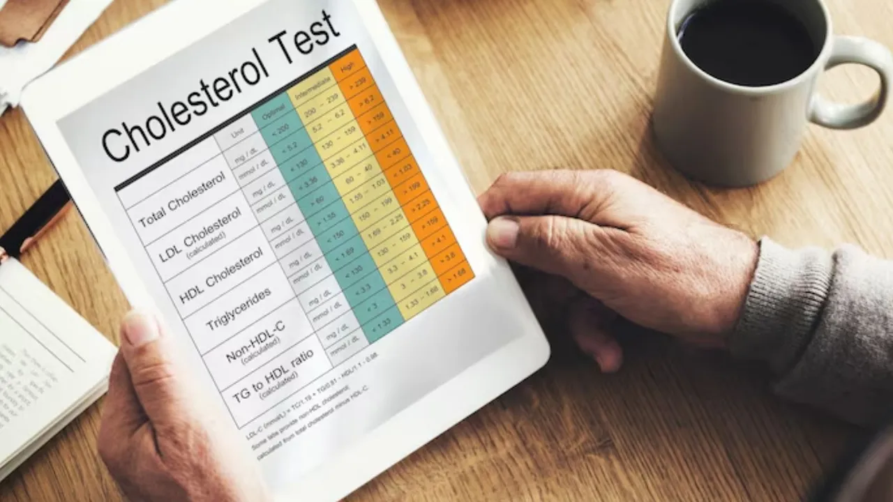 cholesterol test