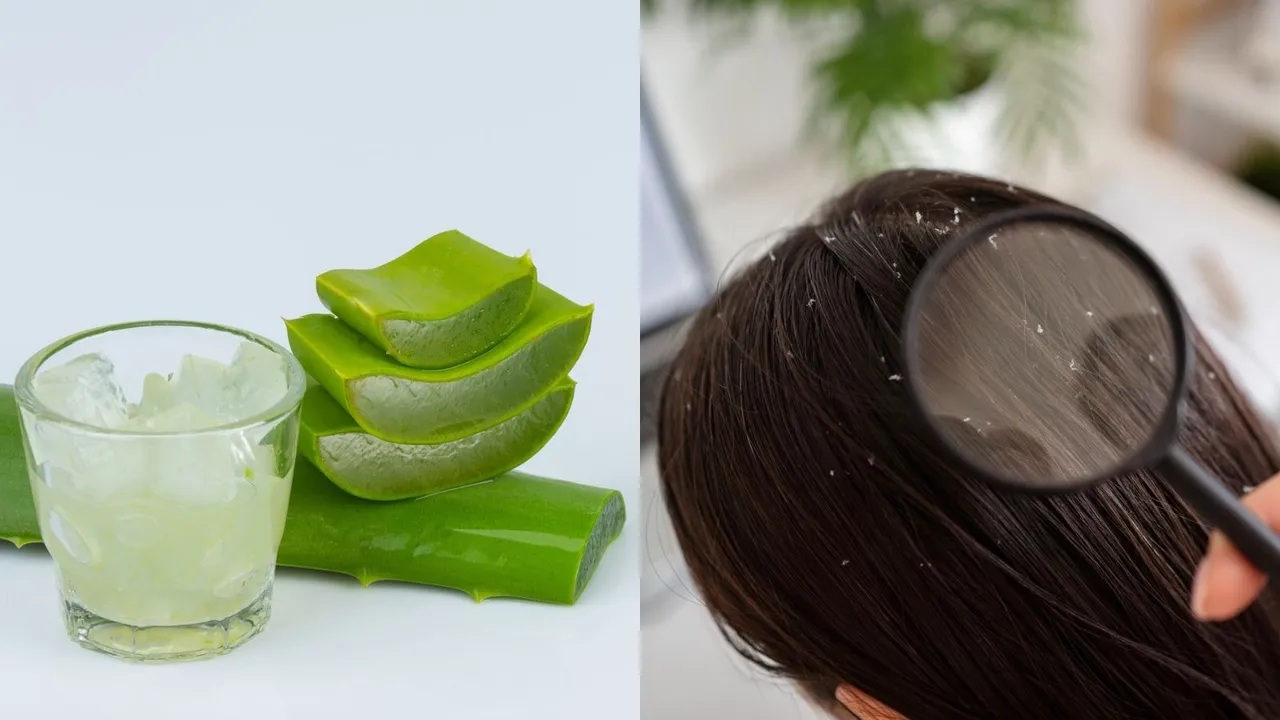 Remove Dandruff Naturally by Aloe Vera | hair care tips | aloe vera for dandruff removal