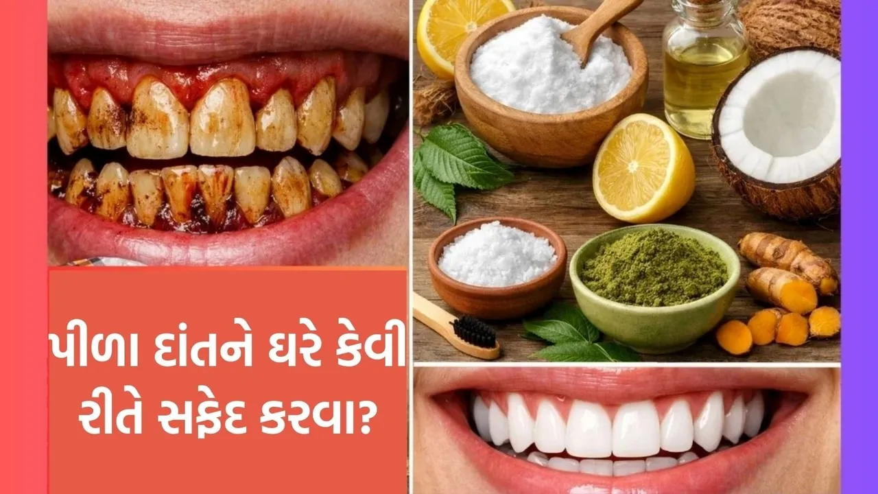 teeth whitening at home