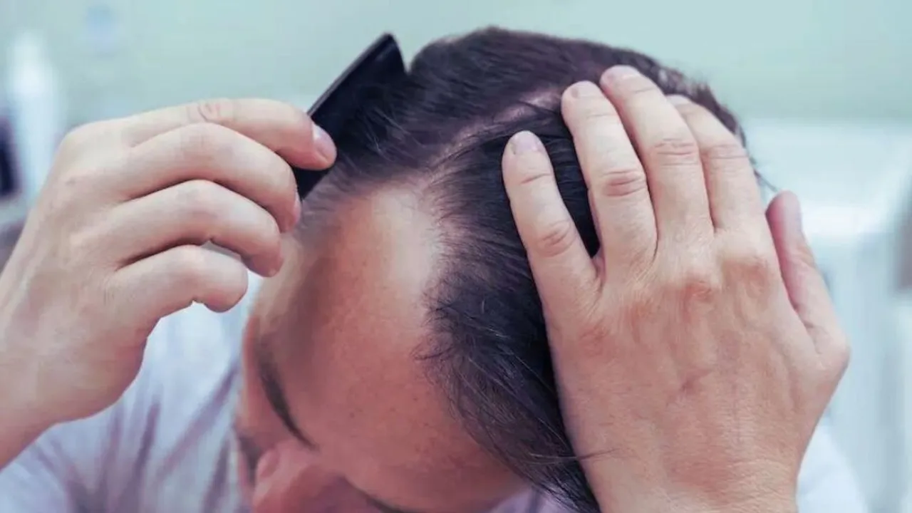 Hair Fall In Young Age