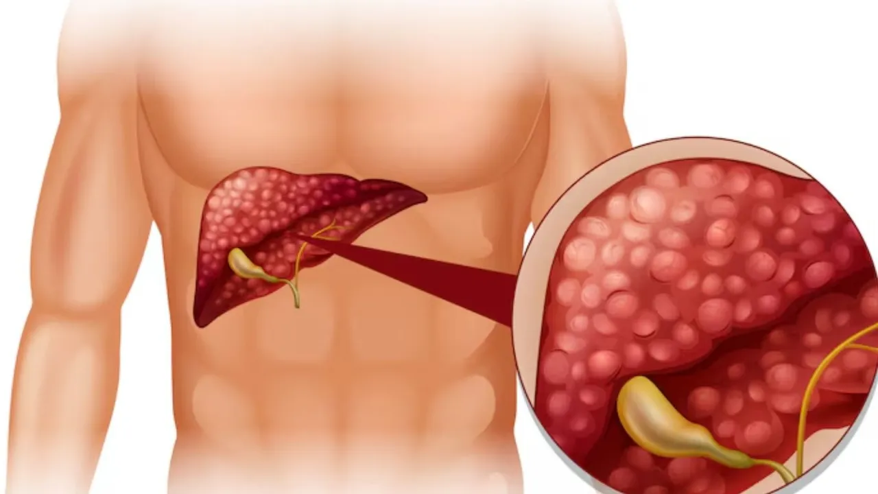 non alcoholic person Liver Cancer Risk