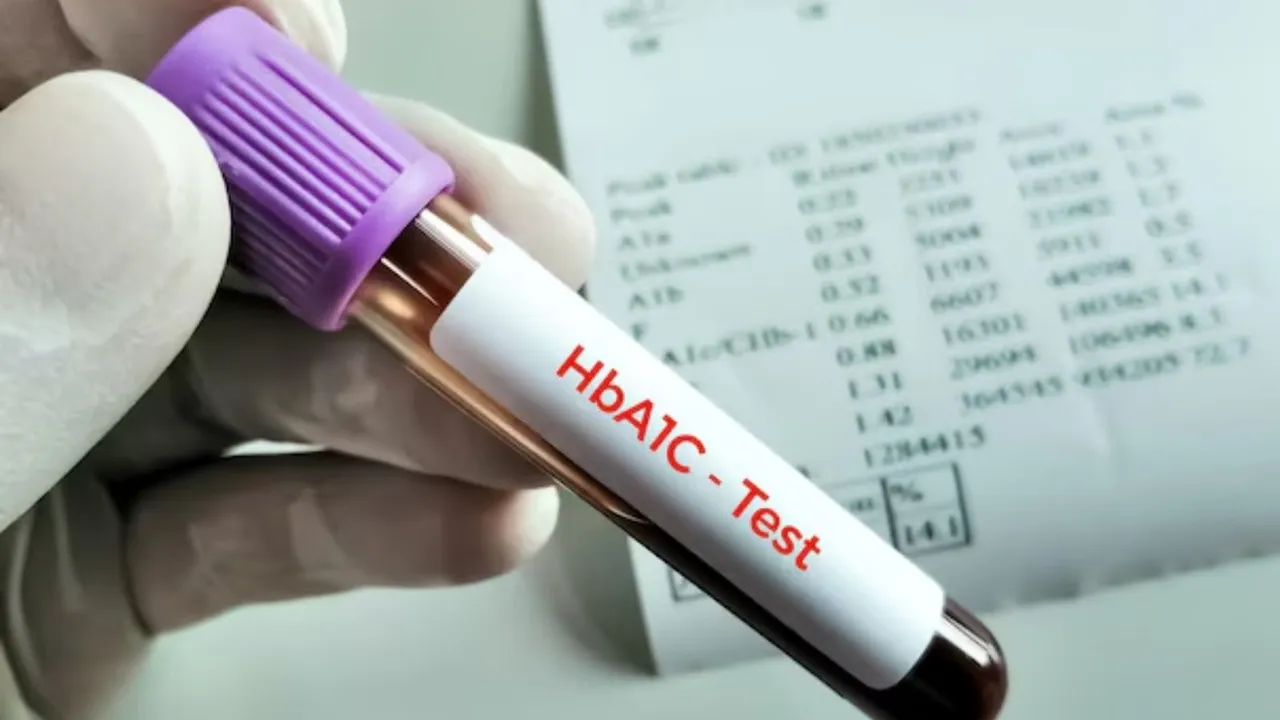 Reasons for failure of HbA1c testing in diabetic patients