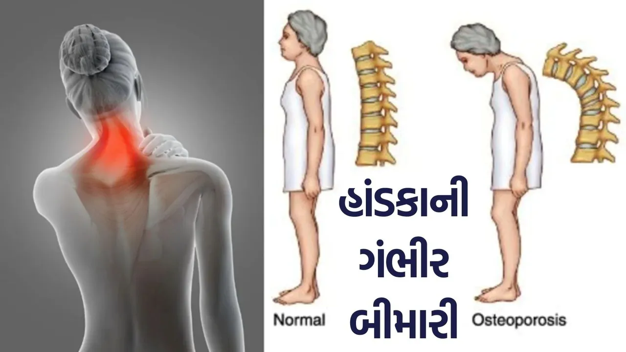Symptoms of osteoporosis